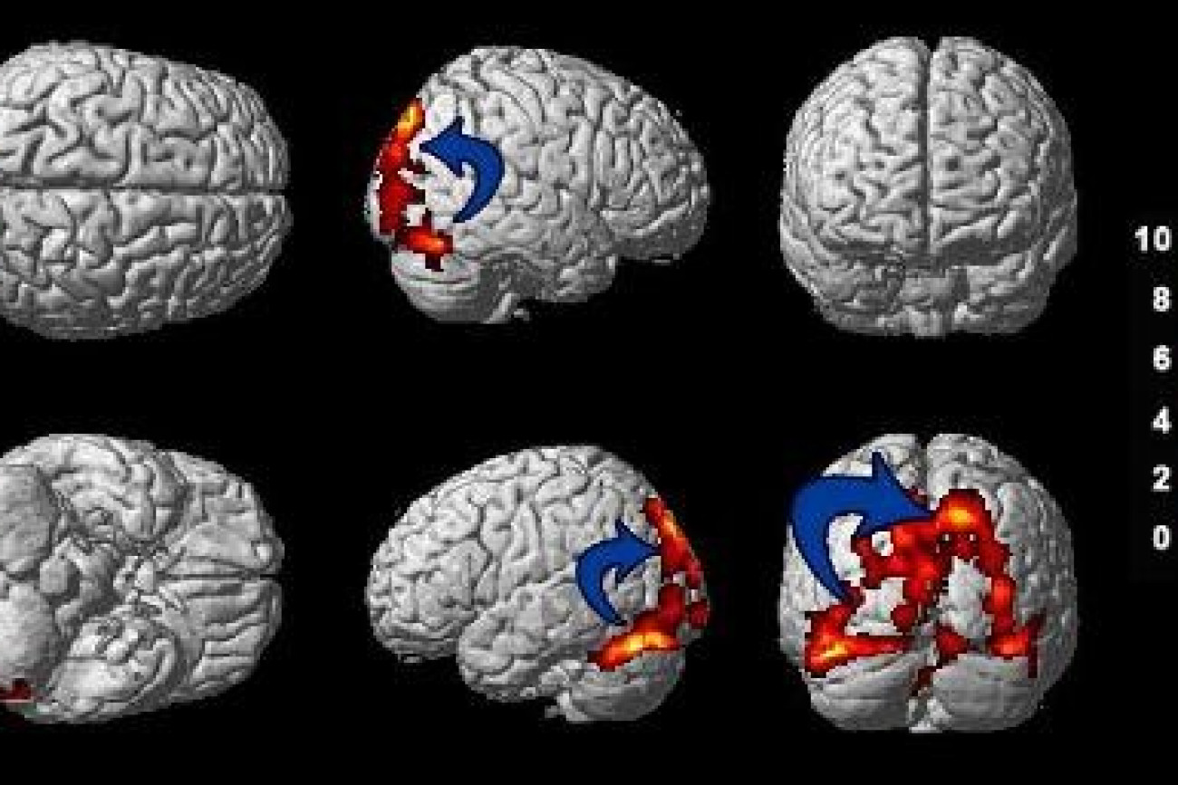 Mapeo Cerebral Entrenamiento Cerebral